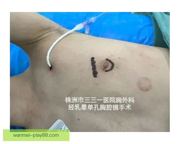 坎宁安气胸康复持续推进 活塞计划一周后复查评估